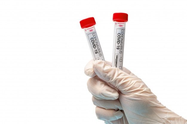 COVID-19 Test Kits